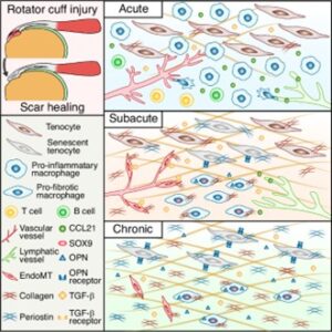 Single-Cell Atlas Reveals Why Rotator Cuff Injuries Heal with Damaging Scars
